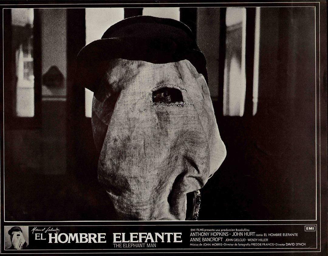 象人The Elephant Man(1980)插图1%4K电影下载_3D影视资源_杜比视界迅雷下载