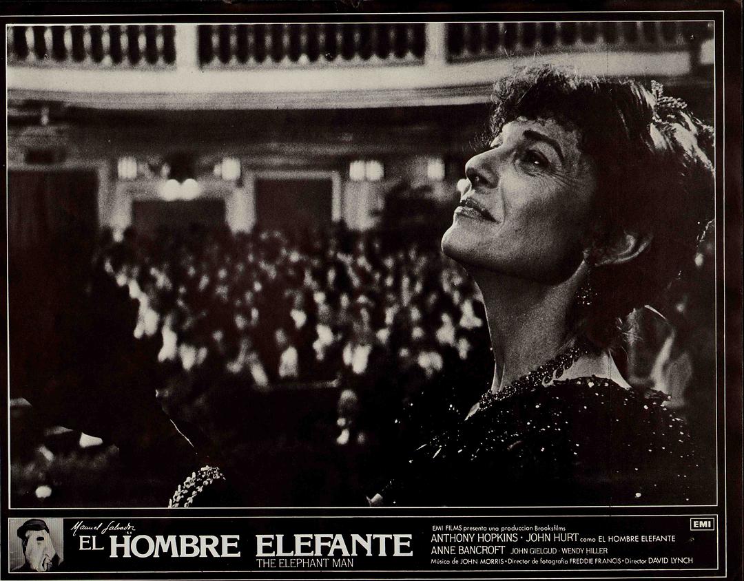 象人The Elephant Man(1980)插图2%4K电影下载_3D影视资源_杜比视界迅雷下载